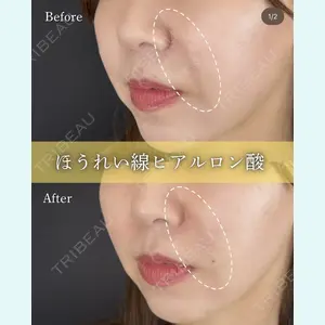 ルラ美容クリニック 京都院の症例