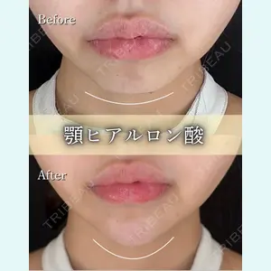 ルラ美容クリニック 京都院の症例