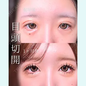 東京シンデレラ美容外科 池袋院 石井 達也医師の症例