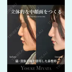 シンデレラ＆ダヴィンチクリニック 宮田 洋佑医師の症例