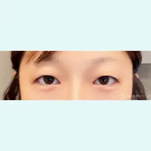 症例
