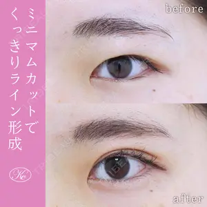 症例