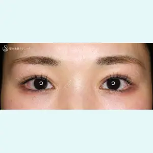 聖心美容クリニック 札幌院 前多 一彦医師の症例