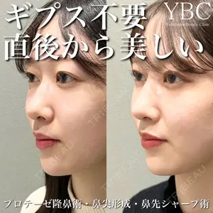 症例