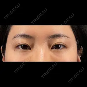 PRISM Beauty Clinicの症例