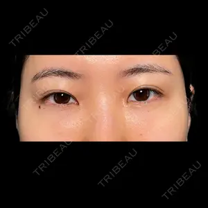 PRISM Beauty Clinicの症例