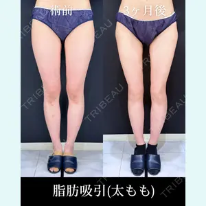 症例