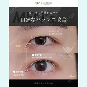 症例