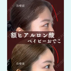 症例