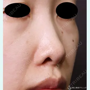 症例