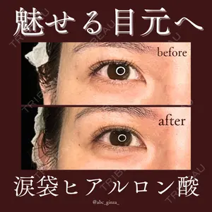 症例