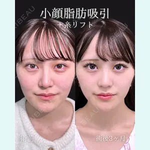 東京シンデレラ美容外科 池袋院 石井 達也医師の症例