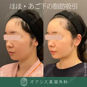 オアシス美容外科 遠藤 剛史医師の症例
