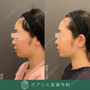 オアシス美容外科 遠藤 剛史医師の症例