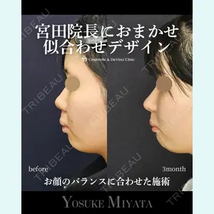 シンデレラ＆ダヴィンチクリニック 宮田 洋佑医師の症例