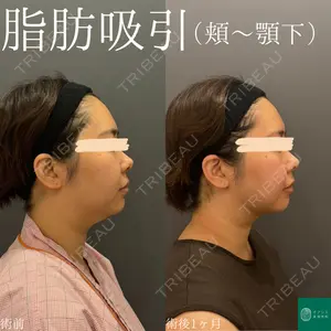 オアシス美容外科 遠藤 剛史医師の症例