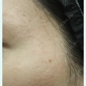 下北沢スキンクリニック 保坂 宗孝医師の症例