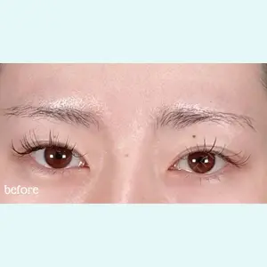 神戸スイミー皮膚科美容外科の症例