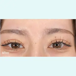 神戸スイミー皮膚科美容外科の症例