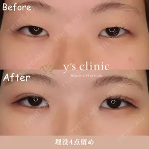y's clinicの症例