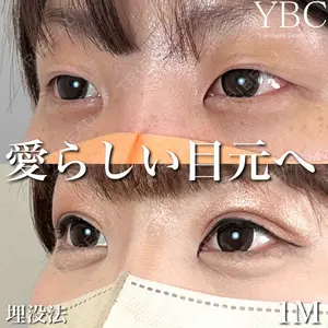 症例