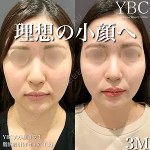 症例