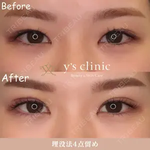 y's clinicの症例
