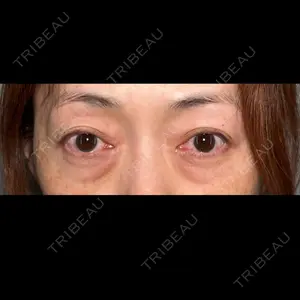 PRISM Beauty Clinicの症例