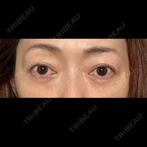 PRISM Beauty Clinicの症例