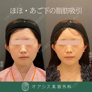 オアシス美容外科 遠藤 剛史医師の症例