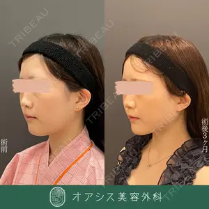 オアシス美容外科 遠藤 剛史医師の症例