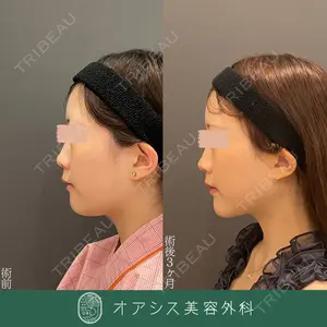 オアシス美容外科 遠藤 剛史医師の症例