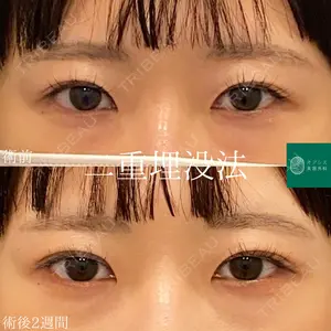 オアシス美容外科 遠藤 剛史医師の症例