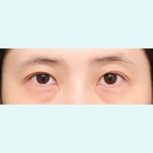 プリモ麻布十番クリニック 大場教弘医師の症例