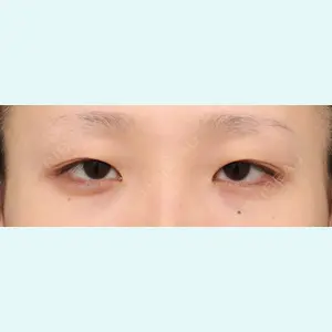 プリモ麻布十番クリニック 大場教弘医師の症例