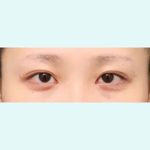 プリモ麻布十番クリニック 大場教弘医師の症例