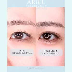 症例