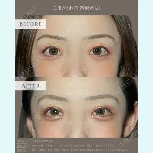 eクリニック 名古屋院 服部 健人医師の症例