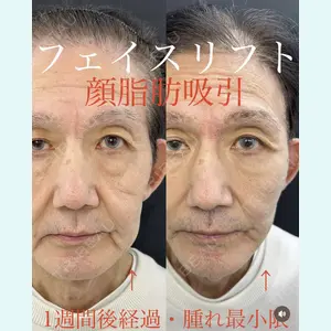 症例