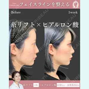 症例