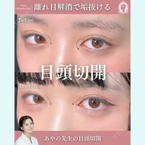 症例
