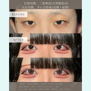 症例
