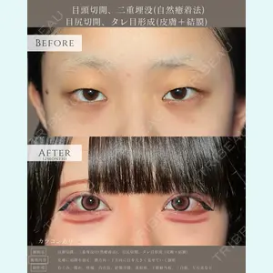 eクリニック 名古屋院 服部 健人医師の症例