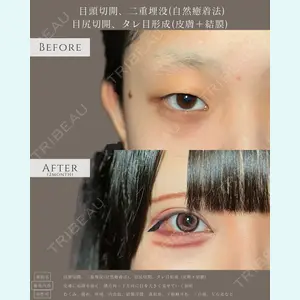 症例