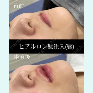HAAB×DREAM BEAUTY CLINIC 大阪梅田院 錦 実奈医師の症例
