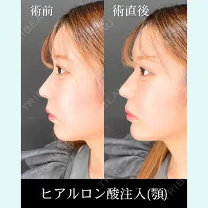 HAAB×DREAM BEAUTY CLINIC 大阪梅田院 錦 実奈医師の症例
