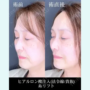 症例