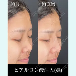 HAAB×DREAM BEAUTY CLINIC 大阪梅田院 錦 実奈医師の症例