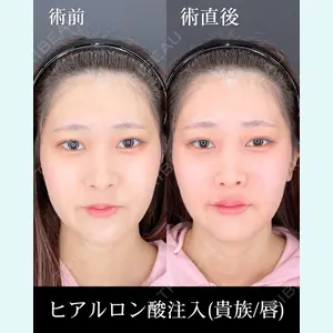 HAAB×DREAM BEAUTY CLINIC 大阪梅田院 錦 実奈医師の症例