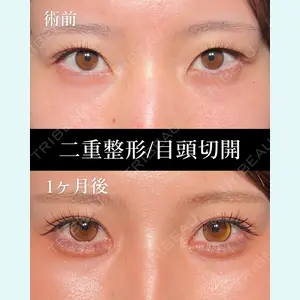 HAAB BEAUTY CLINIC 名古屋院 丸山 舜大医師の症例